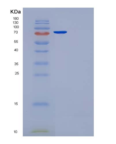 SDS-PAGE analysis of Human FN1 (Fibronectin) - Recombinant Protein, showing >90% purity under 15% SDS-PAGE (Reduced)