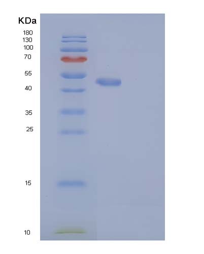 SDS-PAGE analysis of Human RAB27B (Ras-Related Protein Rab-27B) - Recombinant Protein, showing >90% purity under 15% SDS-PAGE (Reduced)