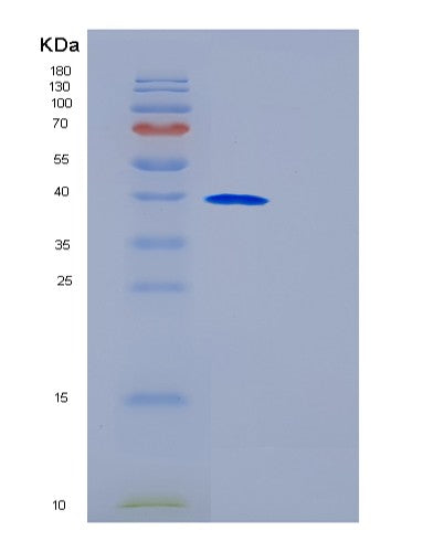 SDS-PAGE analysis of Human GALM (Galactose Mutarotase) - Recombinant Protein, showing >90% purity under 15% SDS-PAGE (Reduced)