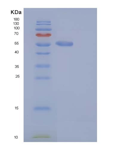 SDS-PAGE analysis of Mouse S100a15a (Protein S100-A15A) - Recombinant Protein, showing >95% purity under 15% SDS-PAGE (Reduced)