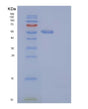 SDS-PAGE analysis of Mouse S100a15a (Protein S100-A15A) - Recombinant Protein, showing >95% purity under 15% SDS-PAGE (Reduced)