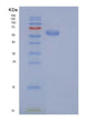 SDS-PAGE analysis of Human CAT (Catalase) - Recombinant Protein, showing >85% purity under 15% SDS-PAGE (Reduced)