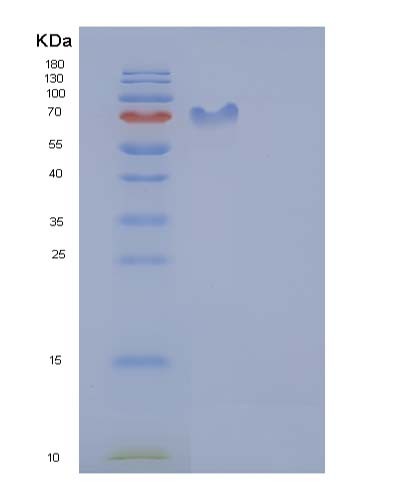 SDS-PAGE analysis of Human ICAM1 (Intercellular Adhesion Molecule 1) - Recombinant Protein, showing >85% purity under 15% SDS-PAGE (Reduced)