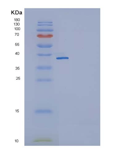 SDS-PAGE analysis of Mouse Il11 (Interleukin-11) - Recombinant Protein, showing >85% purity under 15% SDS-PAGE (Reduced)
