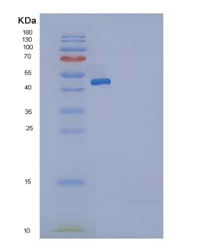 SDS-PAGE analysis of Human SERPING1 (Plasma Protease C1 Inhibitor) - Recombinant Protein, showing >85% purity under 15% SDS-PAGE (Reduced)