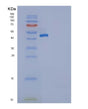 SDS-PAGE analysis of Human SERPING1 (Plasma Protease C1 Inhibitor) - Recombinant Protein, showing >85% purity under 15% SDS-PAGE (Reduced)