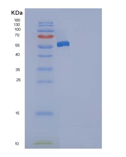 SDS-PAGE analysis of Human ANP32A (Acidic Leucine-Rich Nuclear Phosphoprotein 32 Family Member A) - Recombinant Protein, showing >90% purity under 15% SDS-PAGE (Reduced)