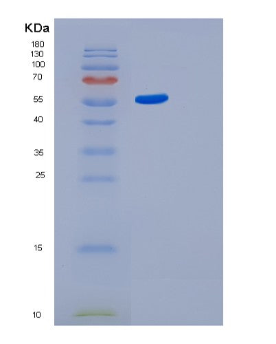 SDS-PAGE analysis of Human GBA3 (Cytosolic Beta-Glucosidase) - Recombinant Protein, showing >95% purity under 15% SDS-PAGE (Reduced)