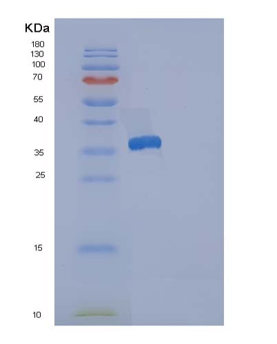 SDS-PAGE analysis of Human RCN3 (Reticulocalbin-3) - Recombinant Protein, showing >95% purity under 15% SDS-PAGE (Reduced)