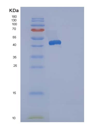 SDS-PAGE analysis of Human ACP1 (Low Molecular Weight Phosphotyrosine Protein Phosphatase) - Recombinant Protein, showing >90% purity under 15% SDS-PAGE (Reduced)