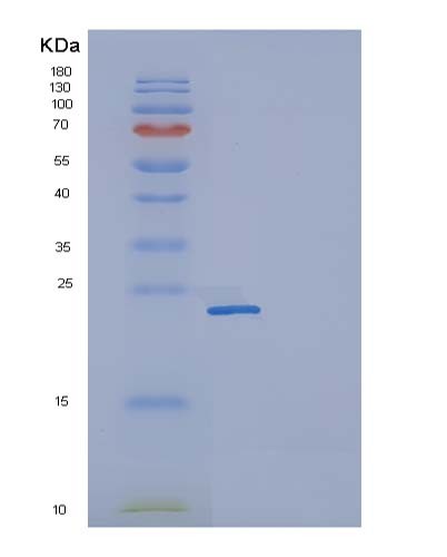 SDS-PAGE analysis of Human FCGR2A (Low Affinity Immunoglobulin Gamma Fc Region Receptor Ii-A) - Recombinant Protein, showing >95% purity under 15% SDS-PAGE (Reduced)