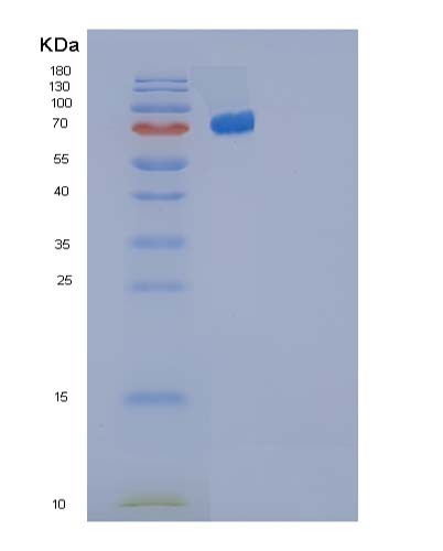 SDS-PAGE analysis of Human IL12A (Interleukin-12 Subunit Alpha) - Recombinant Protein, showing >95% purity under 15% SDS-PAGE (Reduced)
