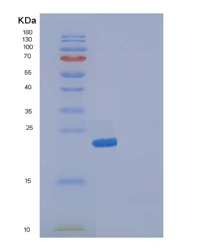 SDS-PAGE analysis of Human IL19 (Interleukin-19) - Recombinant Protein, showing >85% purity under 15% SDS-PAGE (Reduced)