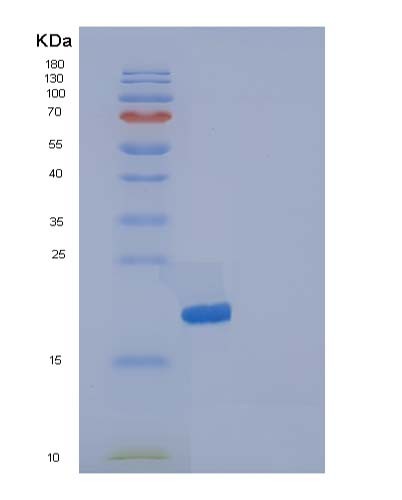 SDS-PAGE analysis of Human IL36RN (Interleukin-36 Receptor Antagonist Protein) - Recombinant Protein, showing >95% purity under 15% SDS-PAGE (Reduced)