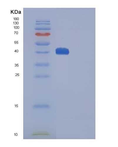 SDS-PAGE analysis of Mouse Ctla4 (Cytotoxic T-Lymphocyte Protein 4) - Recombinant Protein, showing >95% purity under 15% SDS-PAGE (Reduced)