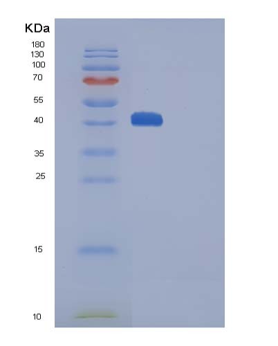 SDS-PAGE analysis of Human CTLA4 (Cytotoxic T-Lymphocyte Protein 4) - Recombinant Protein, showing >90% purity under 15% SDS-PAGE (Reduced)