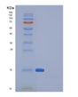 SDS-PAGE analysis of Human SNCA (Alpha-Synuclein) - Recombinant Protein, showing >85% purity under 15% SDS-PAGE (Reduced)