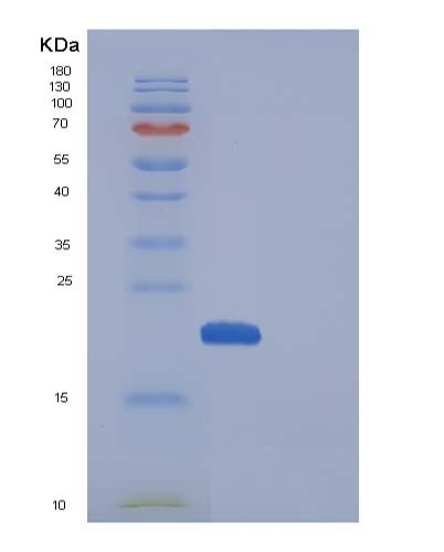 SDS-PAGE analysis of Mouse Manf (Mesencephalic Astrocyte-Derived Neurotrophic Factor) - Recombinant Protein, showing >85% purity under 15% SDS-PAGE (Reduced)