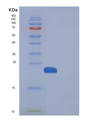 SDS-PAGE analysis of Human MANF (Mesencephalic Astrocyte-Derived Neurotrophic Factor) - Recombinant Protein, showing >95% purity under 15% SDS-PAGE (Reduced)