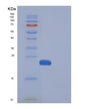 SDS-PAGE analysis of Human MANF (Mesencephalic Astrocyte-Derived Neurotrophic Factor) - Recombinant Protein, showing >95% purity under 15% SDS-PAGE (Reduced)