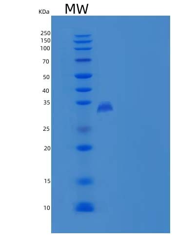 SDS-PAGE analysis of Human CNPY4 (Protein Canopy Homolog 4) - Recombinant Protein, showing >85% purity under 15% SDS-PAGE (Reduced)