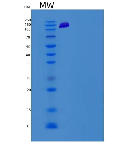 SDS-PAGE analysis of Mouse Prkcd (Protein Kinase C Delta Type) - Recombinant Protein, showing >90% purity under 15% SDS-PAGE (Reduced)