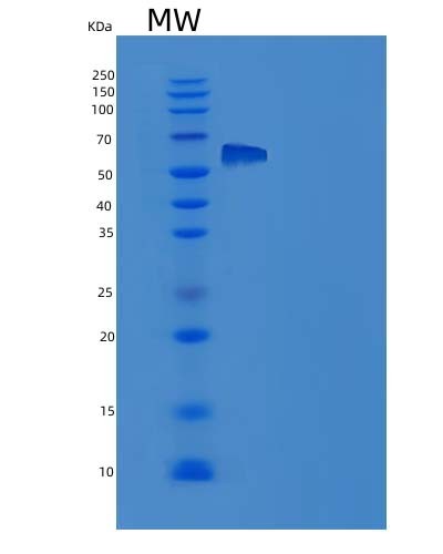 SDS-PAGE analysis of Human IL1RAPL1 (Interleukin-1 Receptor Accessory Protein-Like 1) - Recombinant Protein, showing >95% purity under 15% SDS-PAGE (Reduced)