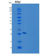 SDS-PAGE analysis of Mouse Cd2 (T-Cell Surface Antigen Cd2) - Recombinant Protein, showing >95% purity under 15% SDS-PAGE (Reduced)