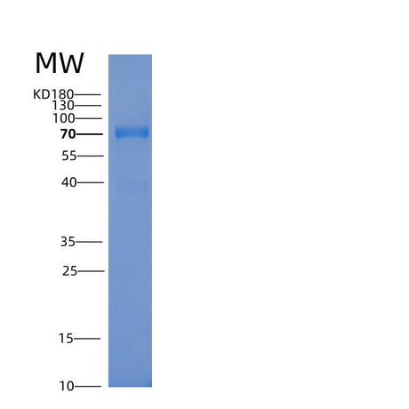 SDS-PAGE analysis of Human RPS6KB1 (Ribosomal Protein S6 Kinase Beta-1) - Recombinant Protein, showing >85% purity under 15% SDS-PAGE (Reduced)