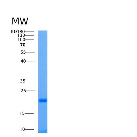 SDS-PAGE analysis of Human UBE2L6 (Ubiquitin/Isg15-Conjugating Enzyme E2 L6) - Recombinant Protein, showing >90% purity under 15% SDS-PAGE (Reduced)