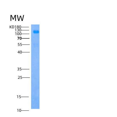 SDS-PAGE analysis of Human IGSF3 (Immunoglobulin Superfamily Member 3) - Recombinant Protein, showing >85% purity under 15% SDS-PAGE (Reduced)