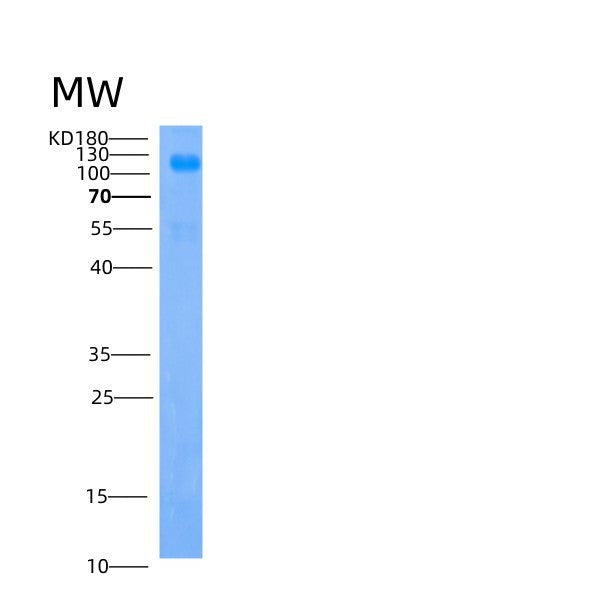 SDS-PAGE analysis of Human IGSF3 (Immunoglobulin Superfamily Member 3) - Recombinant Protein, showing >85% purity under 15% SDS-PAGE (Reduced)