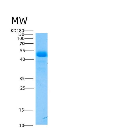SDS-PAGE analysis of Mouse Smpdl3a (Cyclic Gmp-Amp Phosphodiesterase Smpdl3A) - Recombinant Protein, showing >95% purity under 15% SDS-PAGE (Reduced)