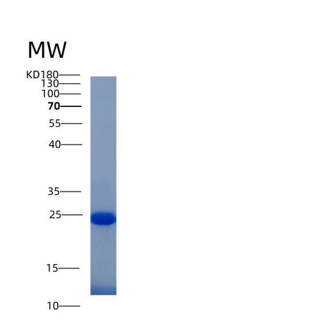 SDS-PAGE analysis of Human IFI30 (Gamma-Interferon-Inducible Lysosomal Thiol Reductase) - Recombinant Protein, showing >90% purity under 15% SDS-PAGE (Reduced)