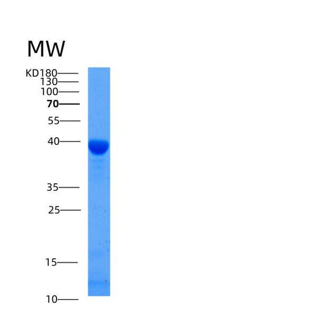 SDS-PAGE analysis of Mouse Gfod2 (Glucose-Fructose Oxidoreductase Domain-Containing Protein 2) - Recombinant Protein, showing >85% purity under 15% SDS-PAGE (Reduced)