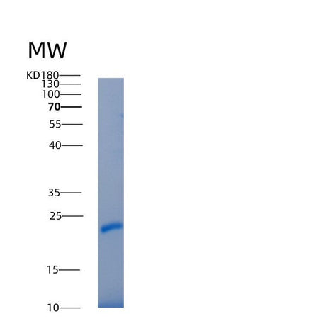 SDS-PAGE analysis of Human IL22RA2 (Interleukin-22 Receptor Subunit Alpha-2) - Recombinant Protein, showing >95% purity under 15% SDS-PAGE (Reduced)
