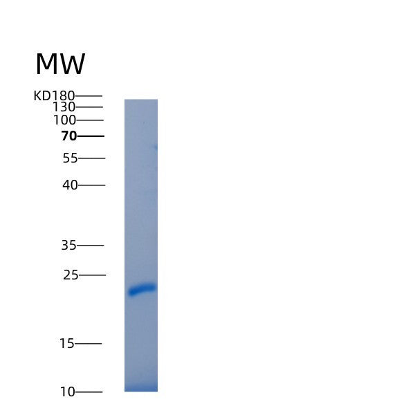 SDS-PAGE analysis of Human IL22RA2 (Interleukin-22 Receptor Subunit Alpha-2) - Recombinant Protein, showing >95% purity under 15% SDS-PAGE (Reduced)