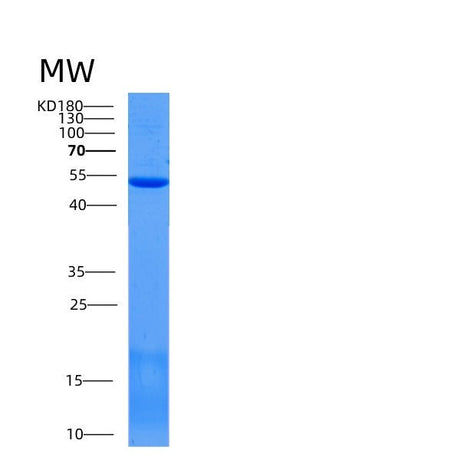 SDS-PAGE analysis of Mouse Scpep1 (Retinoid-Inducible Serine Carboxypeptidase) - Recombinant Protein, showing >85% purity under 15% SDS-PAGE (Reduced)