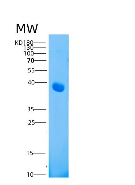 SDS-PAGE analysis of Human LAMP3 (Lysosome-Associated Membrane Glycoprotein 3) - Recombinant Protein, showing >95% purity under 15% SDS-PAGE (Reduced)