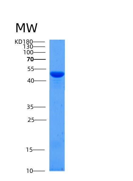 SDS-PAGE analysis of Mouse Serpinb12 (Serpin B12) - Recombinant Protein, showing >85% purity under 15% SDS-PAGE (Reduced)
