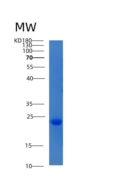 SDS-PAGE analysis of Human CIB2 (Calcium And Integrin-Binding Family Member 2) - Recombinant Protein, showing >90% purity under 15% SDS-PAGE (Reduced)