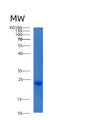 SDS-PAGE analysis of Human CIB2 (Calcium And Integrin-Binding Family Member 2) - Recombinant Protein, showing >90% purity under 15% SDS-PAGE (Reduced)
