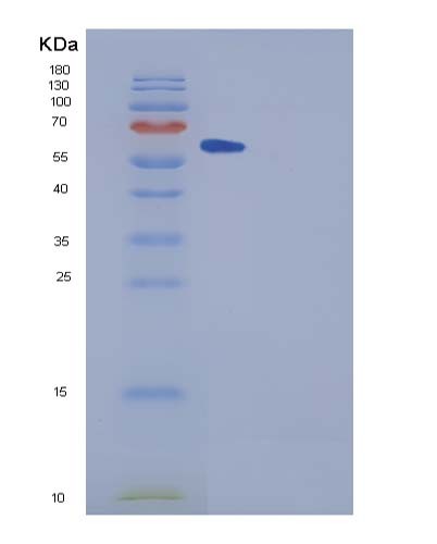 SDS-PAGE analysis of Human SPG21 (Maspardin) - Recombinant Protein, showing >85% purity under 15% SDS-PAGE (Reduced)