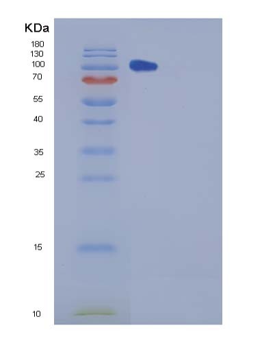 SDS-PAGE analysis of Mouse Chl1 (Neural Cell Adhesion Molecule L1-Like Protein) - Recombinant Protein, showing >95% purity under 15% SDS-PAGE (Reduced)