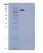 SDS-PAGE analysis of Mouse Chl1 (Neural Cell Adhesion Molecule L1-Like Protein) - Recombinant Protein, showing >95% purity under 15% SDS-PAGE (Reduced)