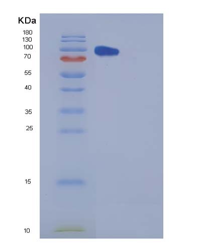 SDS-PAGE analysis of Human CPE (Carboxypeptidase E) - Recombinant Protein, showing >95% purity under 15% SDS-PAGE (Reduced)