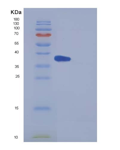 SDS-PAGE analysis of Mouse Il5ra (Interleukin-5 Receptor Subunit Alpha) - Recombinant Protein, showing >90% purity under 15% SDS-PAGE (Reduced)