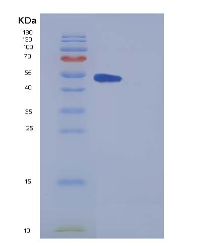 SDS-PAGE analysis of Mouse Metap2 (Methionine Aminopeptidase 2) - Recombinant Protein, showing >85% purity under 15% SDS-PAGE (Reduced)