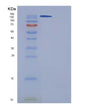 SDS-PAGE analysis of Human A2M (Alpha-2-Macroglobulin) - Recombinant Protein, showing >85% purity under 15% SDS-PAGE (Reduced)