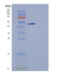 SDS-PAGE analysis of Human PXYLP1 (2-Phosphoxylose Phosphatase 1) - Recombinant Protein, showing >95% purity under 15% SDS-PAGE (Reduced)